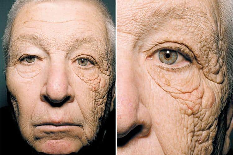 truck driver sun damage        
        <figure class=